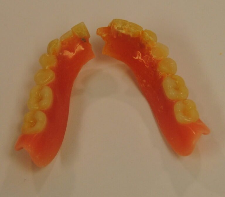 Broken Denture