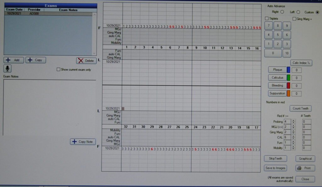Periodontal Charting