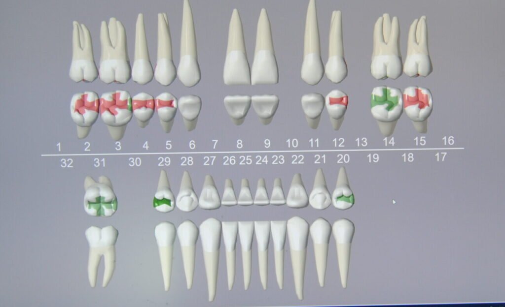 Dental Restorative Charting